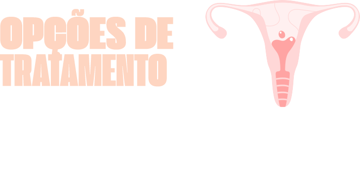 Opções de tratamento para SUA Opções de tratamento para SUA